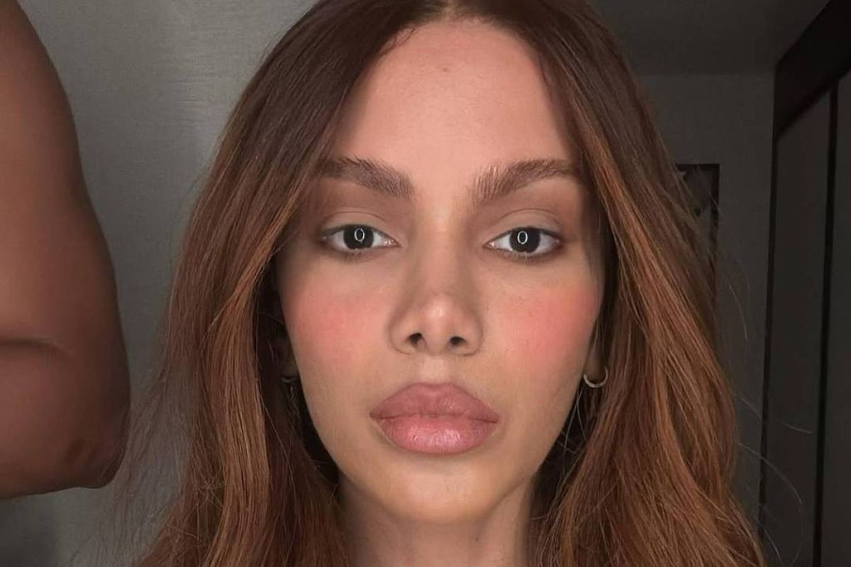 Anitta fala pela 1ª vez sobre procedimento no rosto