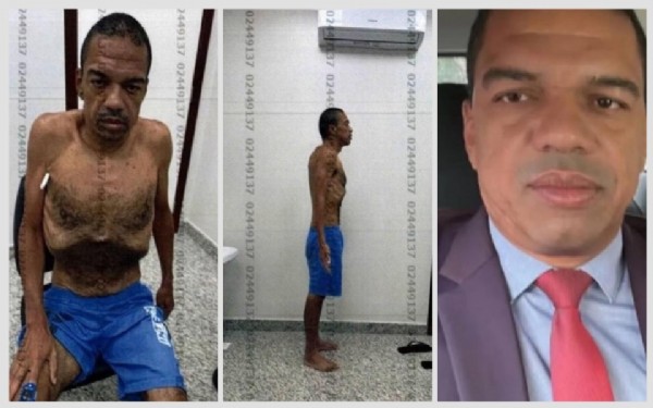 Empresário apontado como lobista sai da cadeia esquálido e com saúde debilitada