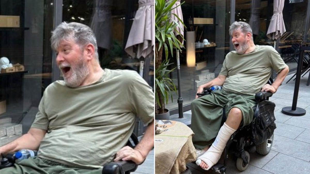 Marcelo Rubens Paiva sofre acidente e quebra a perna