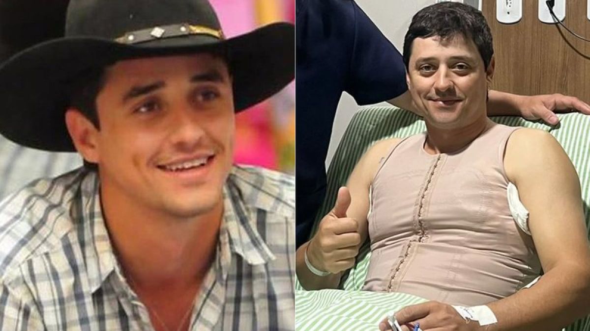 Ex-BBB tranquiliza fãs após cirurgia para retirada de tumor