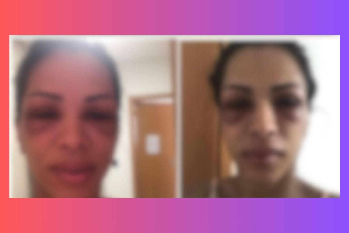 Policial civil passa usar tornozeleira eletrônica após agredir ex-mulher em Cuiabá