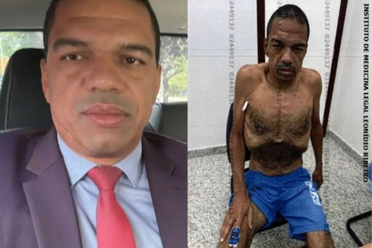 Após ser solto por "estado esquelético", lobista voltou à prisão